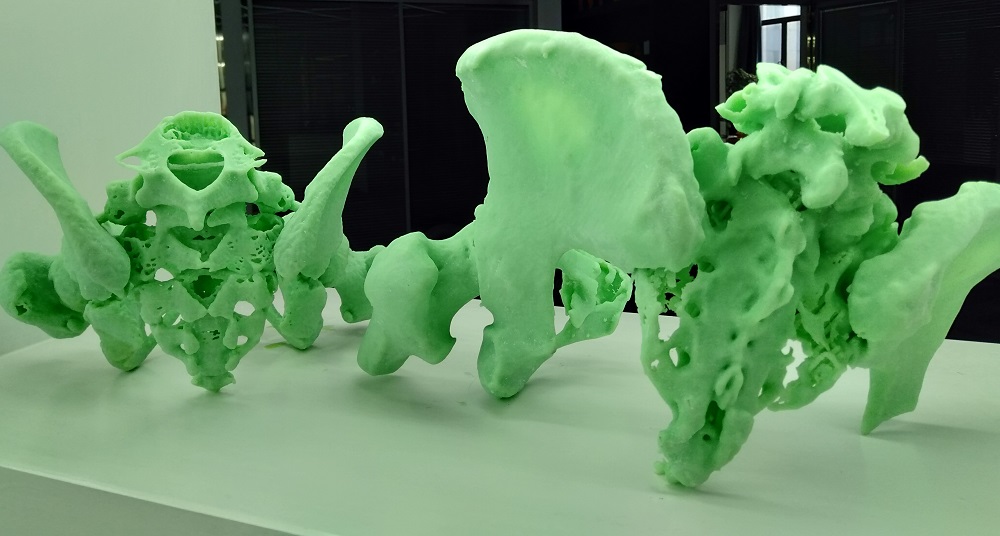 Mô hình xương chậu 3D